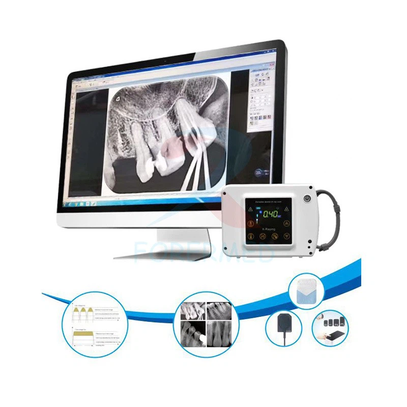 Opg Dental X Ray Opg Dental X Ray