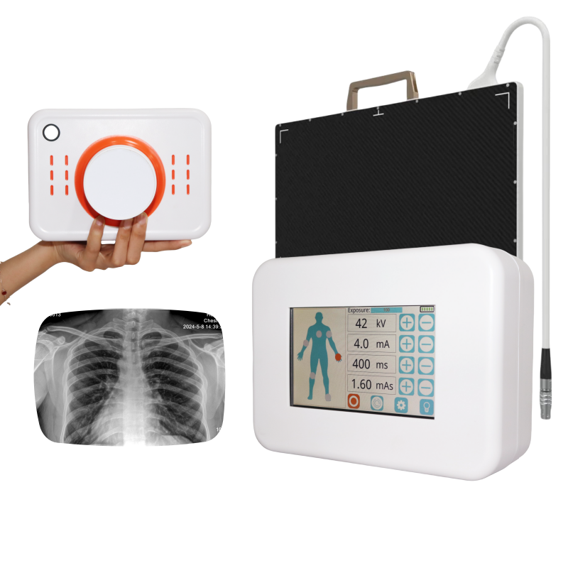 PORTABLE X RAY MACHINE PORTABLE X RAY MACHINE