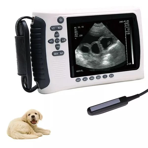 medical portable ultrasound